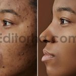 دانلود اکشن فتوشاپ روتوش صورت