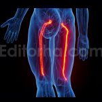 فوتیج انیمیشن سه بعدی اعصاب سیاتیک