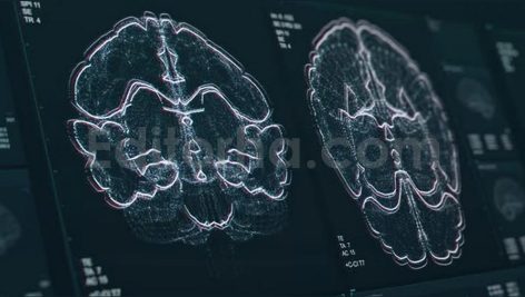 brain scan screen animation the device scans and d