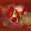 3D animation of clogged and tightened rtery with cholesterol cells