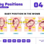Baby Positions in Womb During Pregnancy Poster