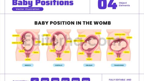 Baby Positions in Womb During Pregnancy Poster