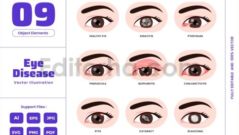 Eye Disease - Human Anatomy Optical Sight Care