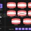 Human Malocclusion Teeth - Treatment Bite Care