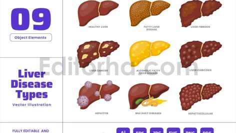 Liver Disease - Internal Human Body Organ Cancer