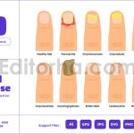 Nail Disease Types - Finger or Toe Infection