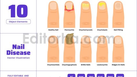 Nail Disease Types - Finger or Toe Infection