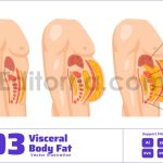 Abdominal Visceral Fat Layers Abdominal Cavity