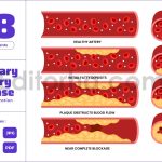 Coronary Artery Disease Types - Heart Blockage