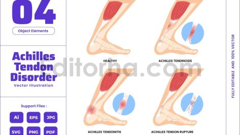 Achilles Tendon Pain Foot and Ankle Muscle Injury