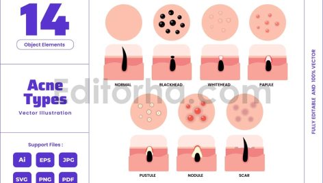 Types of Acne Care - Healthy Skin Dermatology